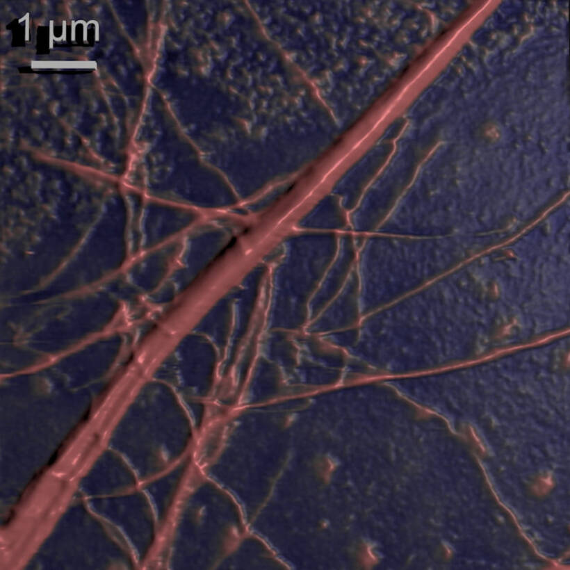 human_cartilage.jpg